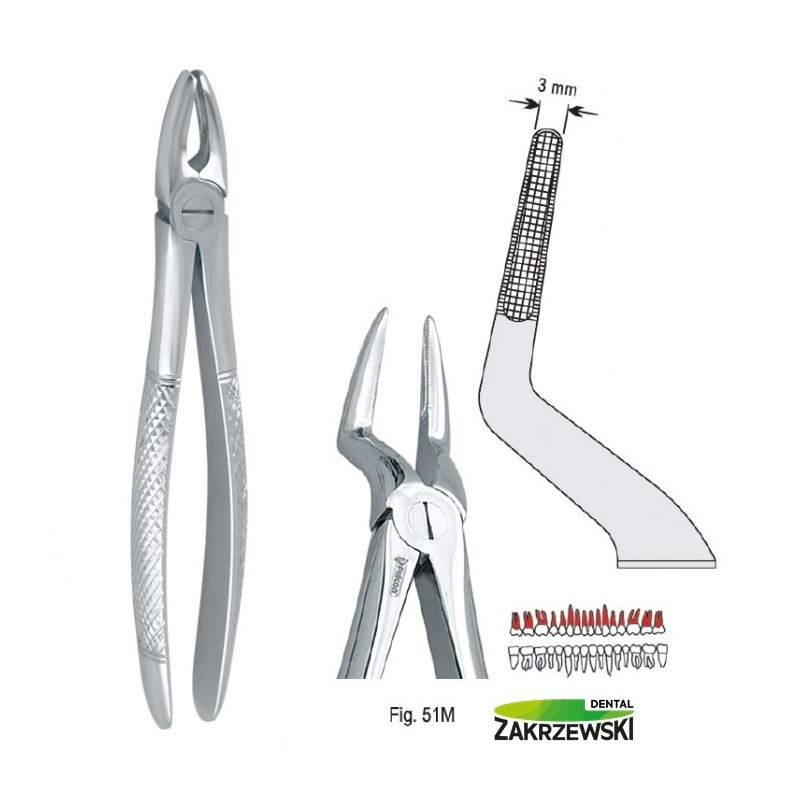 Клещи бертены фиг.51м к верхним корням Сокола