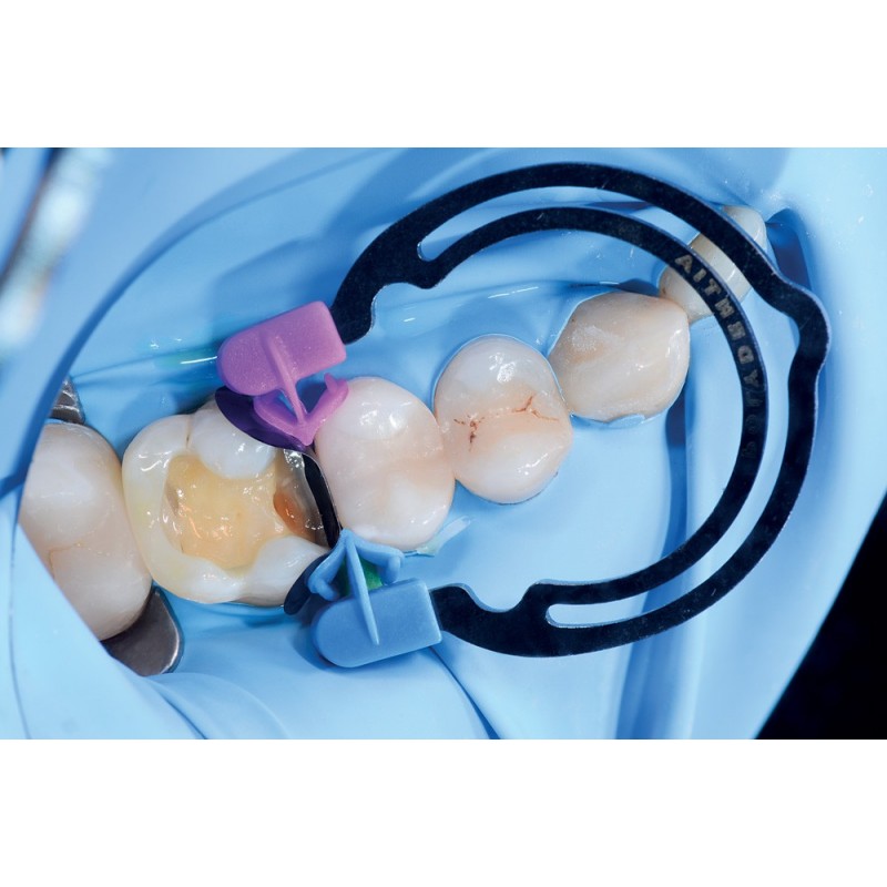 MyRing Forte 6806 op. 2 шт.+ myTines 4 пары Polydentia