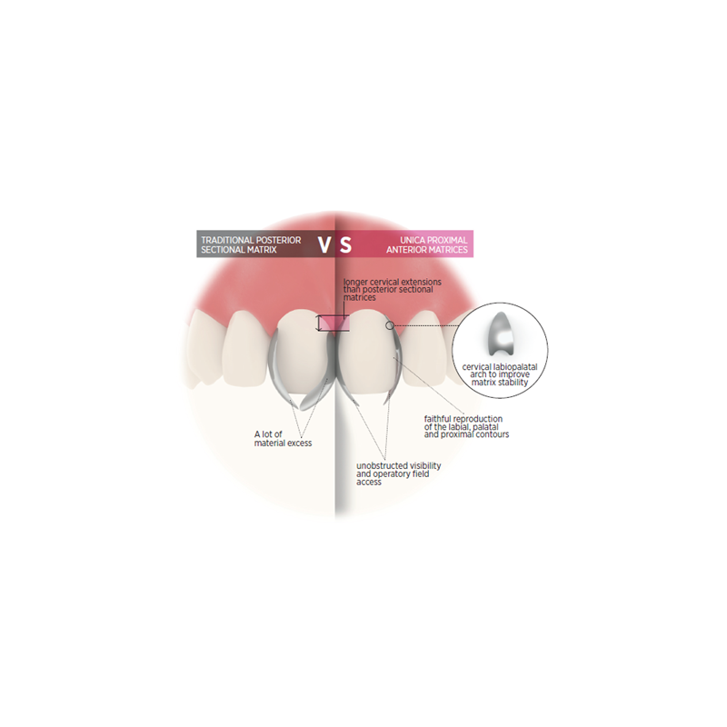 Unica Proximal Anterior Deep 6953 op.50шт. Polydentia