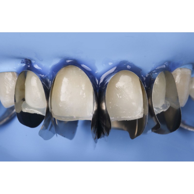 Unica Minideep Anterior 50 szt. 6951 Polydentia