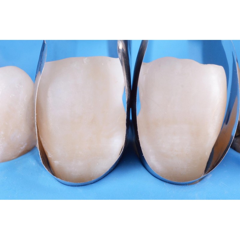 Unica Anterior 50 шт. металлические полоски для передних зубов Polydentia