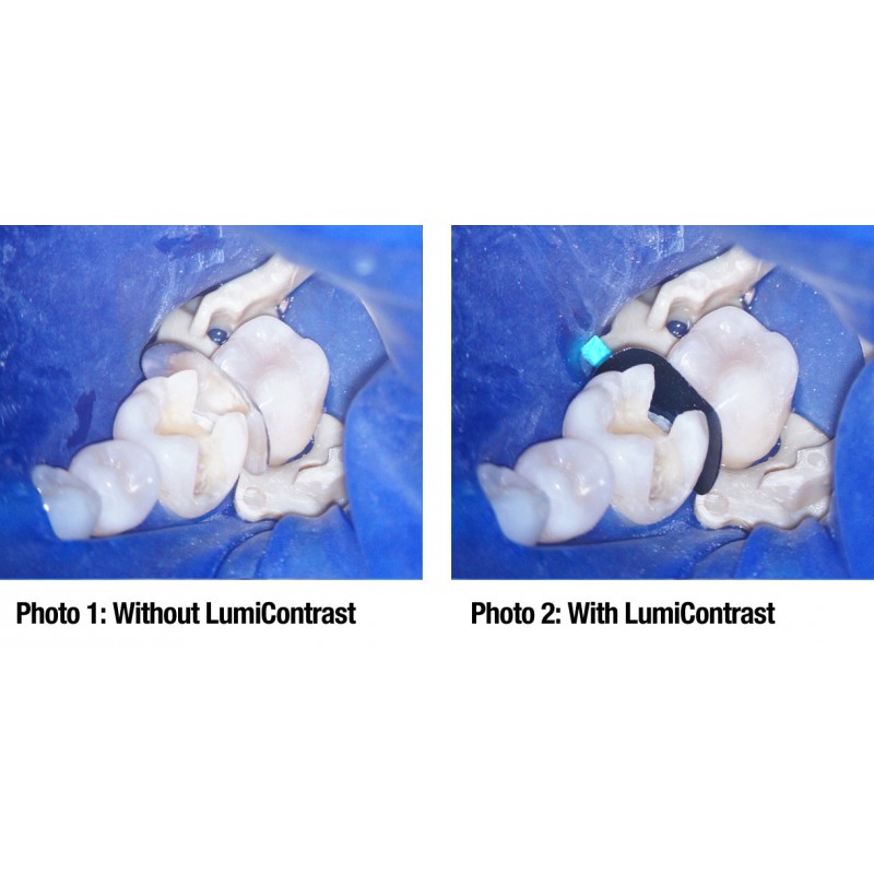 Quickmat LumiContrast ремни для живота 6746 6756 op.50шт. Polydentia