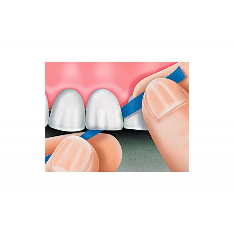 Абразивные полоски Tria-Shine (конические) op.100 шт. Polydentia