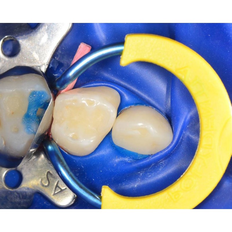 MyRing Junior 6336 op.2 кольца Polydentia